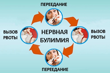 Лечение булимии в Новом Уренгое